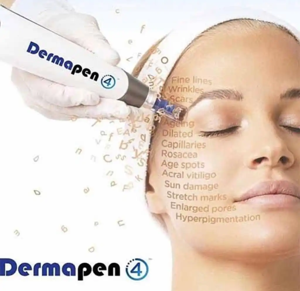 Dermapen 4 microneedling on the face