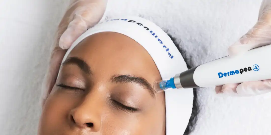 Dermapen microneedling face