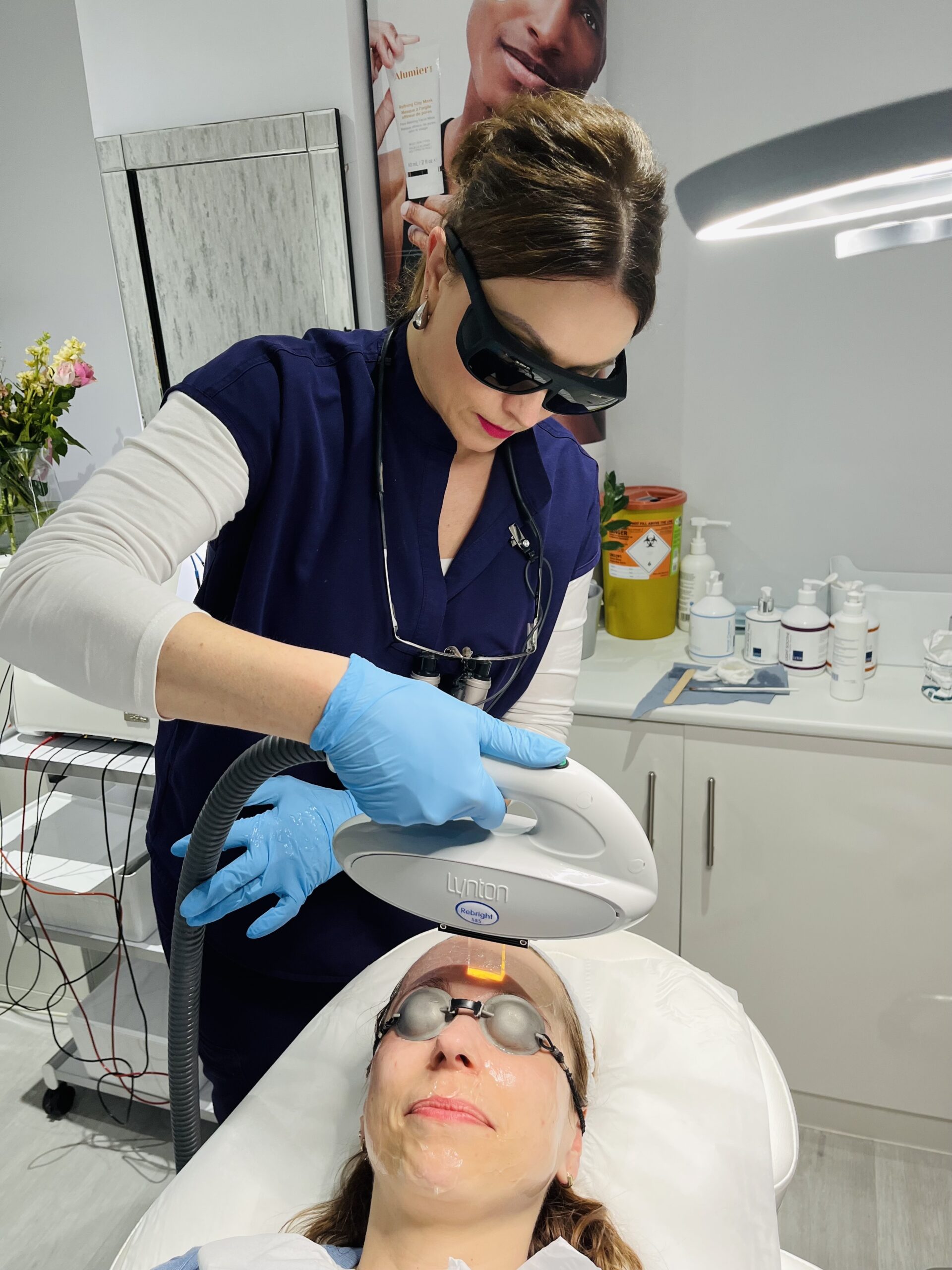 IPL Acne Treatment in Chelsea, London
