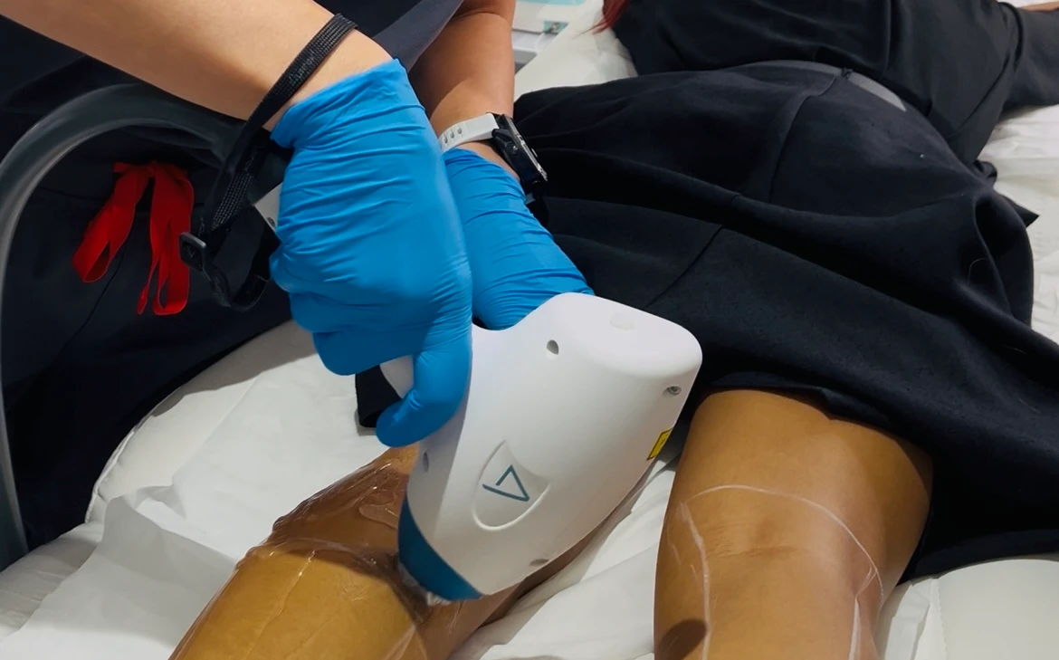 Get Flawlessly Smooth Skin at In‑DERM Skin Clinic’s Laser Hair Reduction in Chelsea, London