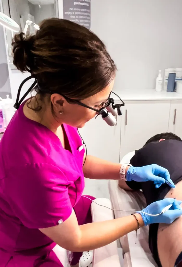 Skin tag removal